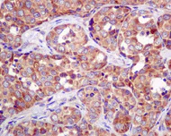 Immunohistochemistry (Formalin/PFA-fixed paraffin-embedded sections) - Anti-APG5L/ATG5 antibody [EPR4797] - BSA and Azide free (AB227084)