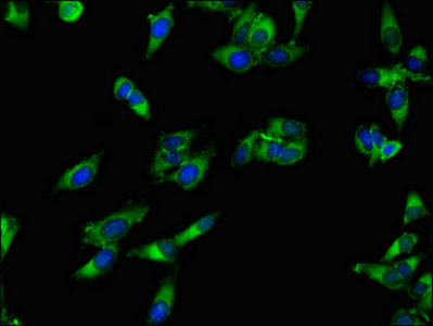 Immunocytochemistry/ Immunofluorescence - Anti-APH antibody (AB236608), expandable thumbnail