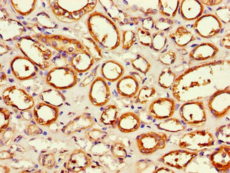Immunohistochemistry (Formalin/PFA-fixed paraffin-embedded sections) - Anti-APH antibody (AB236608), expandable thumbnail