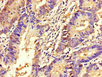 Immunohistochemistry (Formalin/PFA-fixed paraffin-embedded sections) - Anti-APH antibody (AB236608)