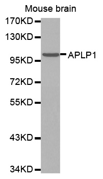 Western blot - Anti-APLP1 antibody (AB192481), expandable thumbnail