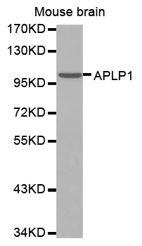Western blot - Anti-APLP1 antibody (AB192481)