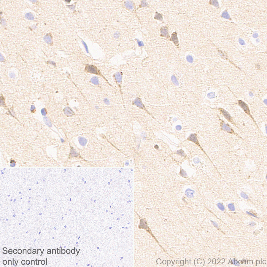 Immunohistochemistry (Formalin/PFA-fixed paraffin-embedded sections) - Anti-APLP1 antibody [EPR25737-10] (ab291070), expandable thumbnail