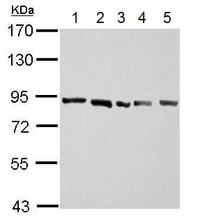 Western blot - Anti-APLP2 antibody (AB137597)