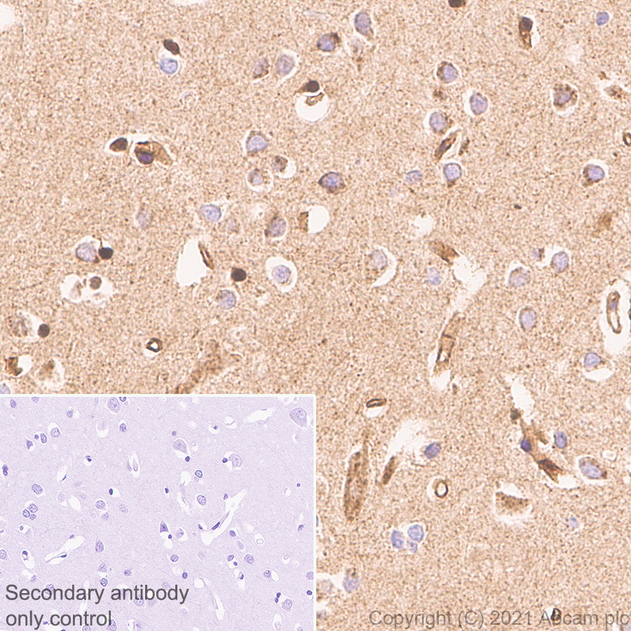 Immunohistochemistry (Formalin/PFA-fixed paraffin-embedded sections) - Anti-APLP2 antibody [EPR5938(2)] (AB140624)