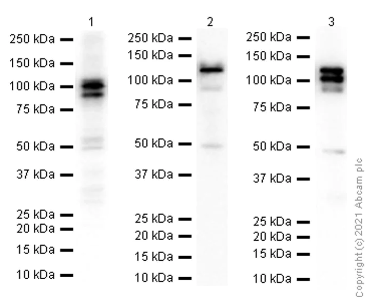 Western blot - Anti-APLP2 antibody [EPR5938(2)] - BSA and Azide free (AB240117)