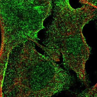 Immunocytochemistry/ Immunofluorescence - Anti-APMAP antibody (AB221453)