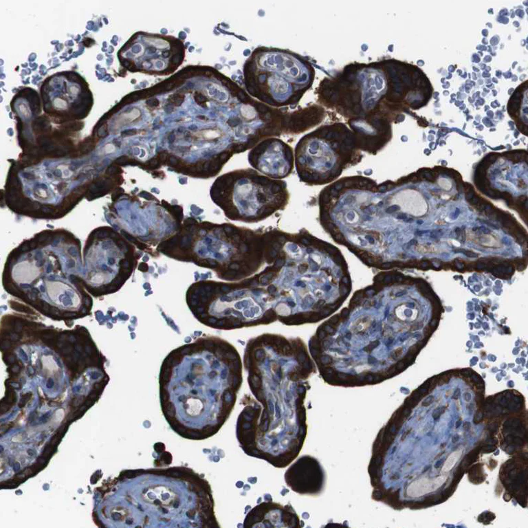 Immunohistochemistry (Formalin/PFA-fixed paraffin-embedded sections) - Anti-APMAP antibody (AB272561)