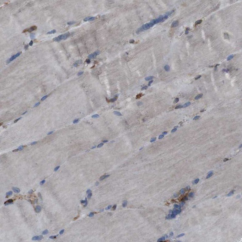 Immunohistochemistry (Formalin/PFA-fixed paraffin-embedded sections) - Anti-APMAP antibody (AB272561)