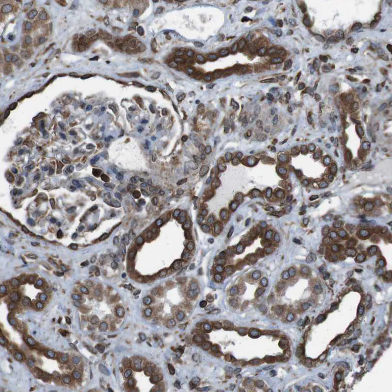 Immunohistochemistry (Formalin/PFA-fixed paraffin-embedded sections) - Anti-APMAP antibody (AB272561)