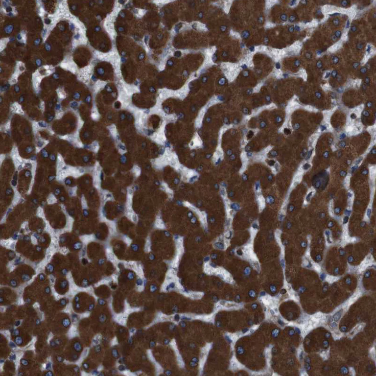 Immunohistochemistry (Formalin/PFA-fixed paraffin-embedded sections) - Anti-APMAP antibody (AB272561)