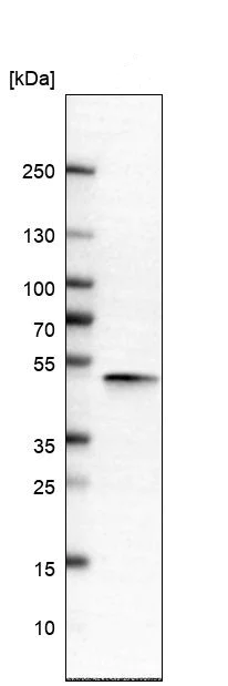 Western blot - Anti-APMAP antibody (AB272561)
