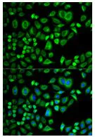 Immunocytochemistry/ Immunofluorescence - Anti-Apo-D antibody (AB196569)