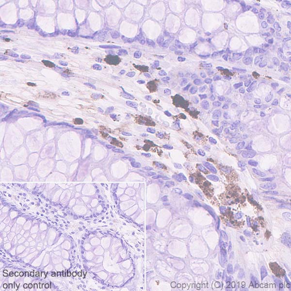 Immunohistochemistry (Formalin/PFA-fixed paraffin-embedded sections) - Anti-Apo-D antibody [EPR22967-72] (AB256496), expandable thumbnail
