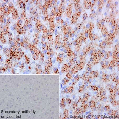 Immunohistochemistry (Formalin/PFA-fixed paraffin-embedded sections) - Anti-Apo-D antibody [EPR2916] (AB108191)