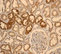 Immunohistochemistry (Formalin/PFA-fixed paraffin-embedded sections) - Anti-Apo-D antibody [EPR2916] - BSA and Azide free (AB247602)