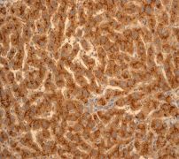 Immunohistochemistry (Formalin/PFA-fixed paraffin-embedded sections) - Anti-Apo-D antibody [EPR2916] - BSA and Azide free (AB247602)