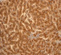 Immunohistochemistry (Formalin/PFA-fixed paraffin-embedded sections) - Anti-Apo-D antibody [EPR2916] - BSA and Azide free (AB247602)