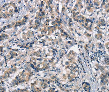Immunohistochemistry (Formalin/PFA-fixed paraffin-embedded sections) - Anti-APOA1BP antibody (AB199130), expandable thumbnail