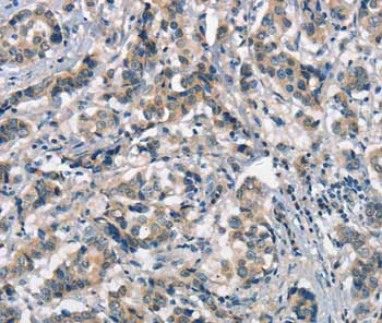 Immunohistochemistry (Formalin/PFA-fixed paraffin-embedded sections) - Anti-APOA1BP antibody (AB199130)