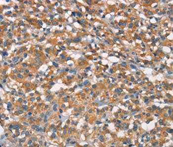 Immunohistochemistry (Formalin/PFA-fixed paraffin-embedded sections) - Anti-APOA1BP antibody (AB199130), expandable thumbnail