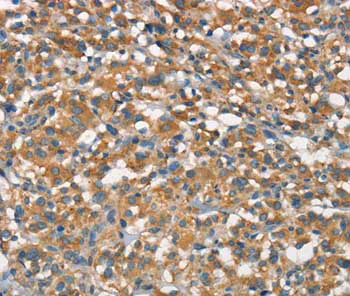 Immunohistochemistry (Formalin/PFA-fixed paraffin-embedded sections) - Anti-APOA1BP antibody (AB199130)