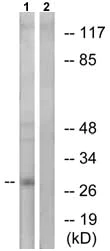 Western blot - Anti-APOA1BP antibody (AB75114)