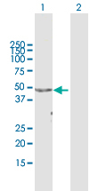 Western blot - Anti-APOA4/Apo-AIV antibody (AB167350), expandable thumbnail