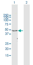Western blot - Anti-APOA4/Apo-AIV antibody (AB167350)