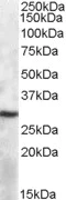 Western blot - Anti-APOBEC1 antibody (AB80493)