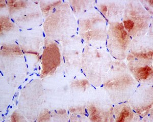 Immunohistochemistry (Formalin/PFA-fixed paraffin-embedded sections) - Anti-APOBEC2 antibody [EPR11285(B)] (AB157205), expandable thumbnail