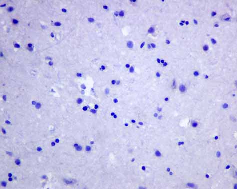 Immunohistochemistry (Formalin/PFA-fixed paraffin-embedded sections) - Anti-APOBEC2 antibody [EPR11285(B)] (AB157205), expandable thumbnail