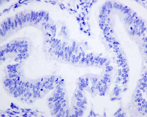Immunohistochemistry (Formalin/PFA-fixed paraffin-embedded sections) - Anti-APOBEC2 antibody [EPR11285(B)] (AB157205), expandable thumbnail