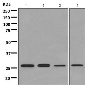 Western blot - Anti-APOBEC2 antibody [EPR11285(B)] (AB157205), expandable thumbnail