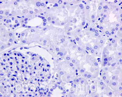 Immunohistochemistry (Formalin/PFA-fixed paraffin-embedded sections) - Anti-APOBEC2 antibody [EPR11286(B)] (AB170859), expandable thumbnail