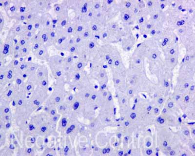 Immunohistochemistry (Formalin/PFA-fixed paraffin-embedded sections) - Anti-APOBEC2 antibody [EPR11286(B)] (AB170859), expandable thumbnail