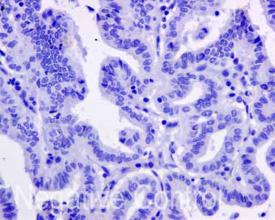 Immunohistochemistry (Formalin/PFA-fixed paraffin-embedded sections) - Anti-APOBEC2 antibody [EPR11286(B)] (AB170859), expandable thumbnail