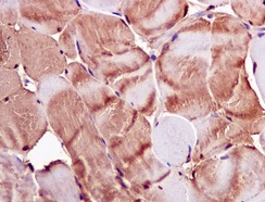 Immunohistochemistry (Formalin/PFA-fixed paraffin-embedded sections) - Anti-APOBEC2 antibody [EPR11286(B)] (AB170859), expandable thumbnail