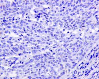 Immunohistochemistry (Formalin/PFA-fixed paraffin-embedded sections) - Anti-APOBEC2 antibody [EPR11286(B)] (ab170859), expandable thumbnail