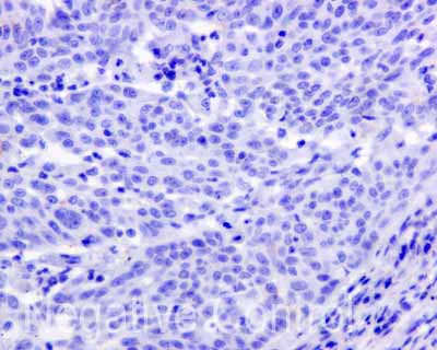 Immunohistochemistry (Formalin/PFA-fixed paraffin-embedded sections) - Anti-APOBEC2 antibody [EPR11286(B)] - BSA and Azide free (AB249542)