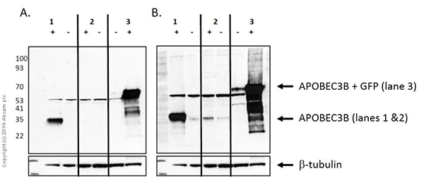 Western blot - Anti-APOBEC3B antibody [EPR18138] (AB184990)