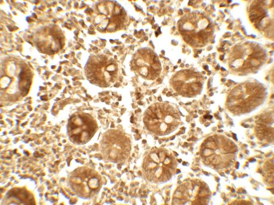 Immunohistochemistry (Formalin/PFA-fixed paraffin-embedded sections) - Anti-APOBEC3B antibody - N-terminal (AB191695)