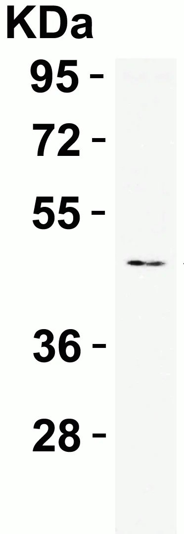 Western blot - Anti-APOBEC3B antibody - N-terminal (AB191695)