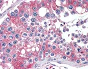 Immunohistochemistry (Formalin/PFA-fixed paraffin-embedded sections) - Anti-APOBEC3G/A3G antibody (AB109727)