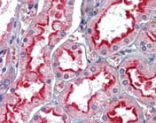 Immunohistochemistry (Formalin/PFA-fixed paraffin-embedded sections) - Anti-APOBEC3G/A3G antibody (AB109727)
