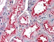 Immunohistochemistry (Formalin/PFA-fixed paraffin-embedded sections) - Anti-APOBEC3G/A3G antibody (AB109727)