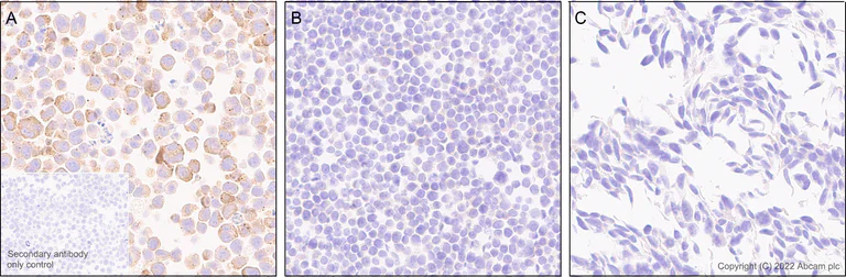 Immunohistochemistry - Anti-APOBEC3G/A3G antibody [EPR25404-59] (AB302926)