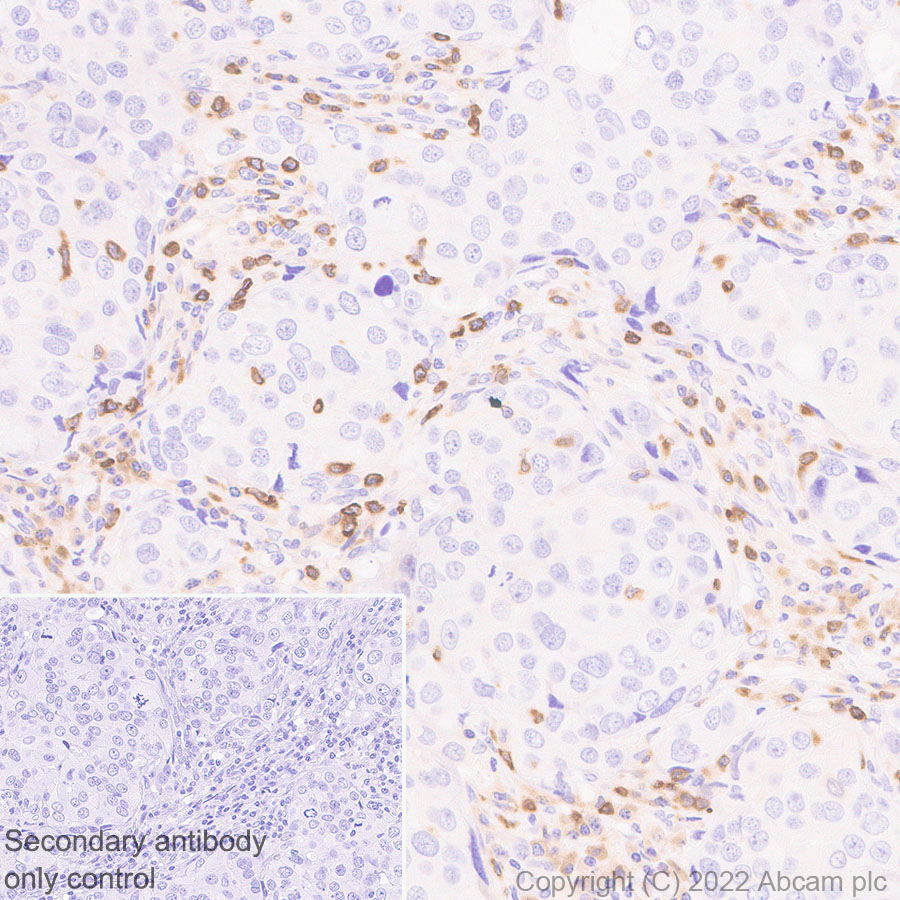 Immunohistochemistry - Anti-APOBEC3G/A3G antibody [EPR25404-59] - BSA and Azide free (ab302927), expandable thumbnail