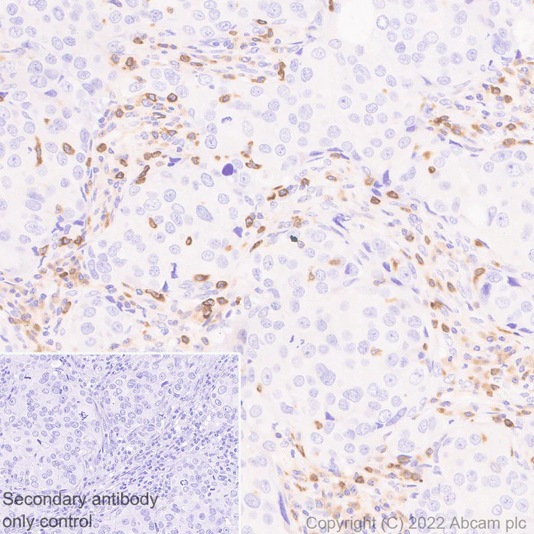 Immunohistochemistry - Anti-APOBEC3G/A3G antibody [EPR25404-59] - BSA and Azide free (AB302927)