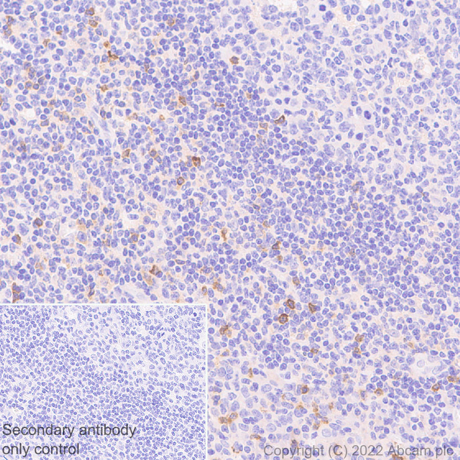Immunohistochemistry - Anti-APOBEC3G/A3G antibody [EPR25404-59] - BSA and Azide free (ab302927), expandable thumbnail